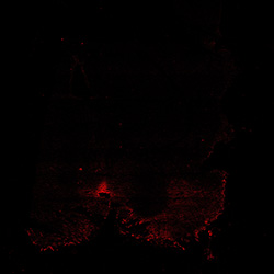 11PCW human midbrain